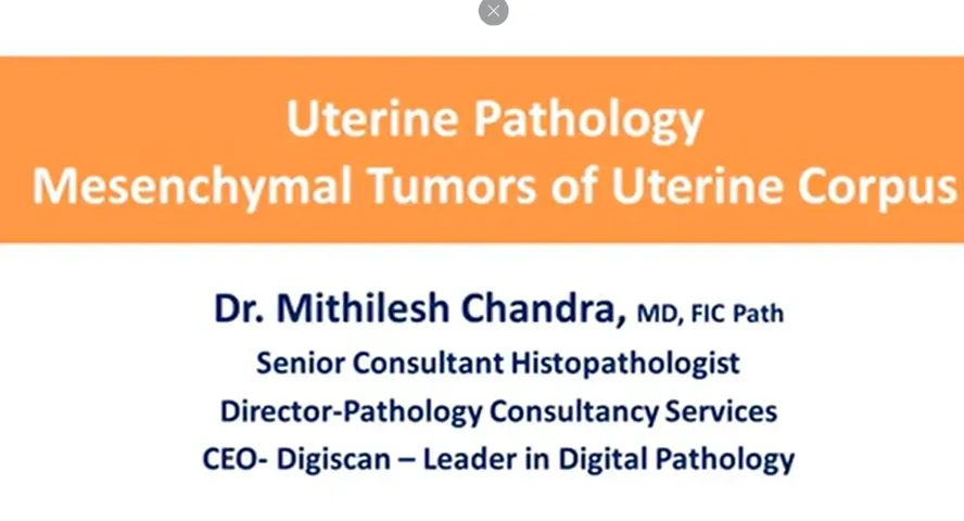 7 Lecture Videos On Uterine Pathology For Beginners Pathlete Org 7 Lecture Videos On Uterine Pathology For Beginners Pathlete Org